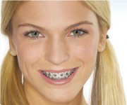 Ortodontijos kaina